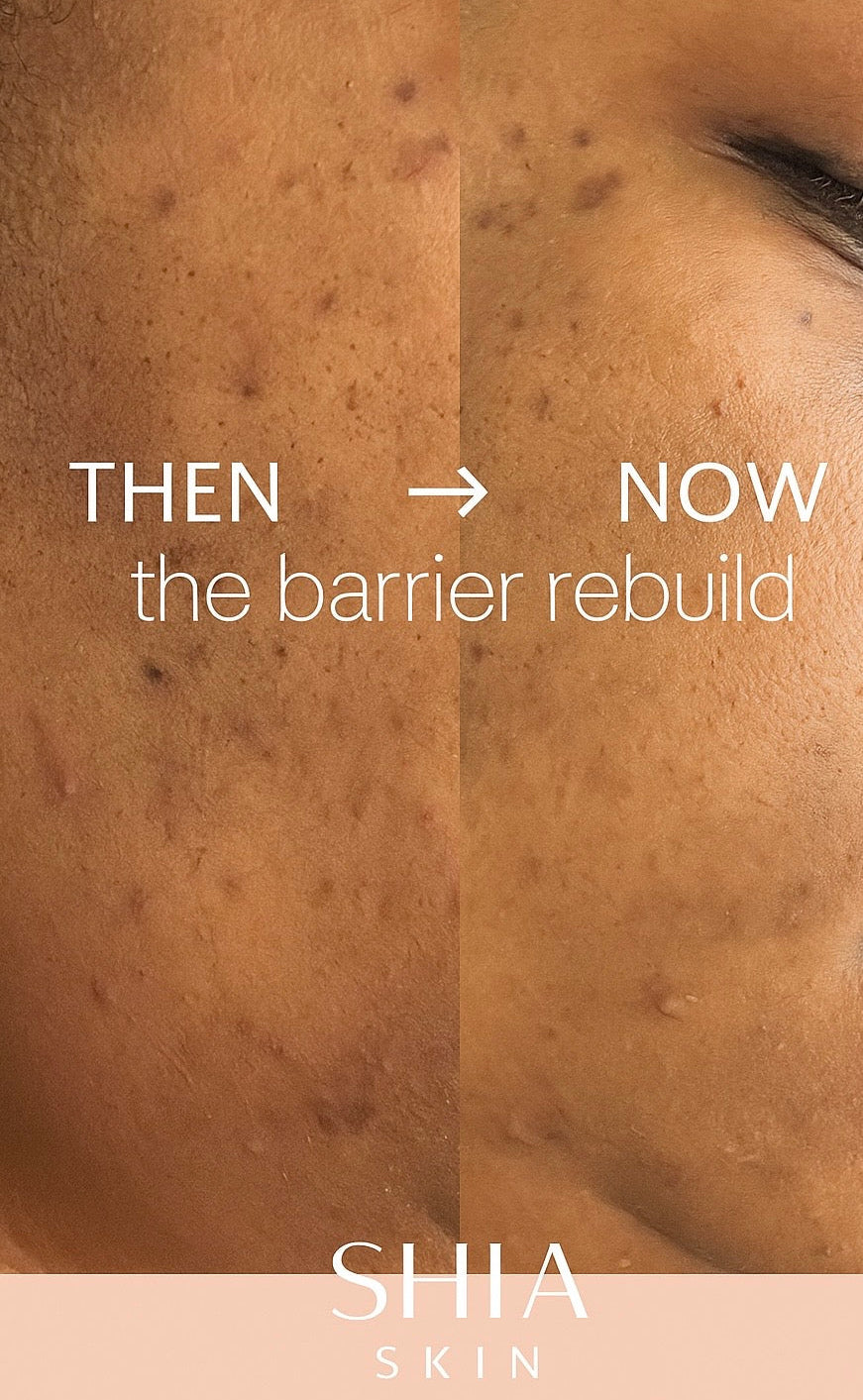 The Reinvented Ritual 3 Step System for Restored, Balanced Skin